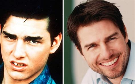 tom cruise teeth don't line up